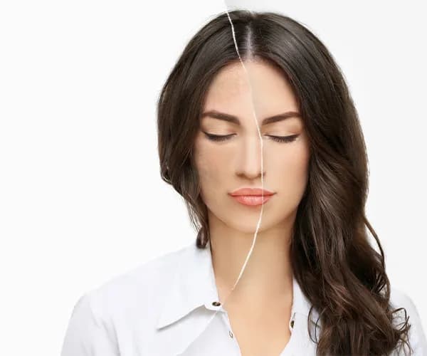 Skin Bio-remodelling Treatment Clinic in Delhi