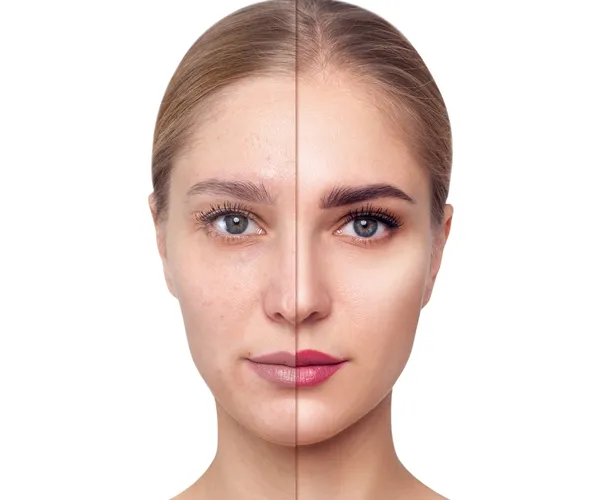 Anti Aging Treatment Clinic in Delhi video