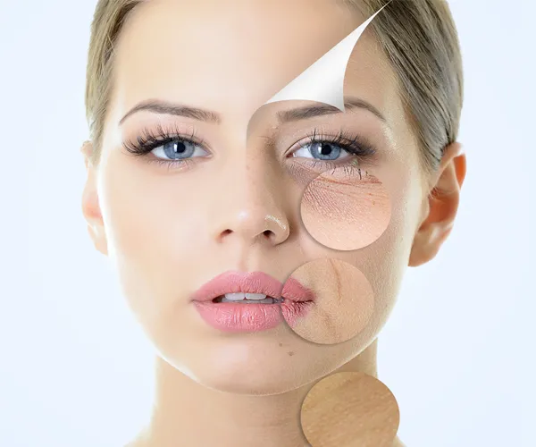 Best Anti Wrinkle Treatment Clinic in Delhi video