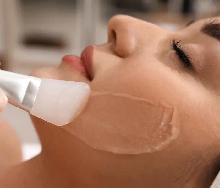 Chemical Peel Treatment Clinic in Delhi video