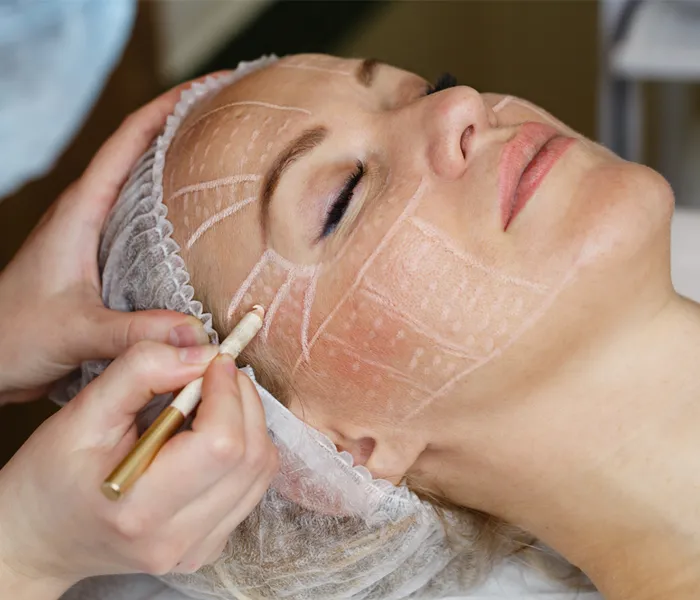 Face Lift Treatment Clinic in Delhi video