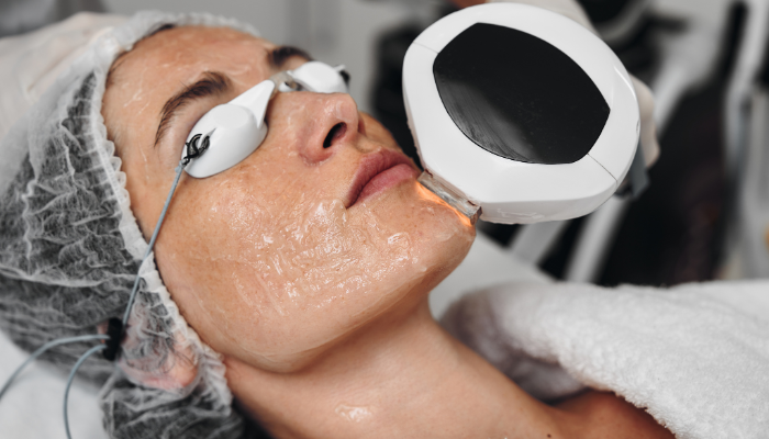 (IPL) Intense Pulsed Light Therapy in Delhi video