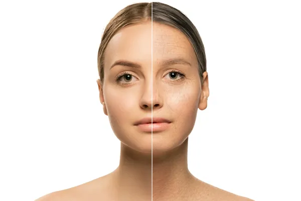 Skin Rejuvenation